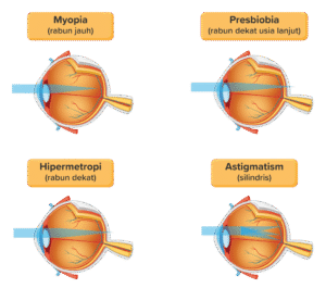 Gangguan Belajar dan Kesehatan Mental: Hubungan yang Kompleks dan Dampaknya pada Individu